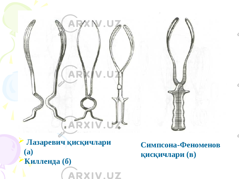  Лазаревич қисқичлари (а)  Килленда (б) Симпсона-Феноменов қисқичлари (в) 