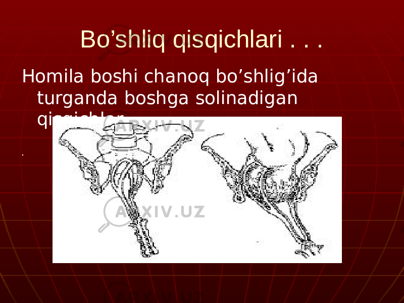 Bo’shliq qisqichlari . . . Homila boshi chanoq bo’shlig’ida turganda boshga solinadigan qisqichlar . . 