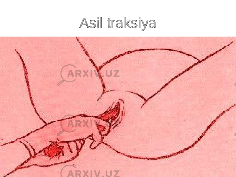 Asil traksiya 