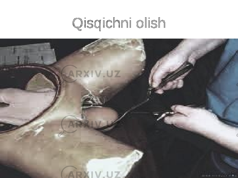 Qisqichni olish 