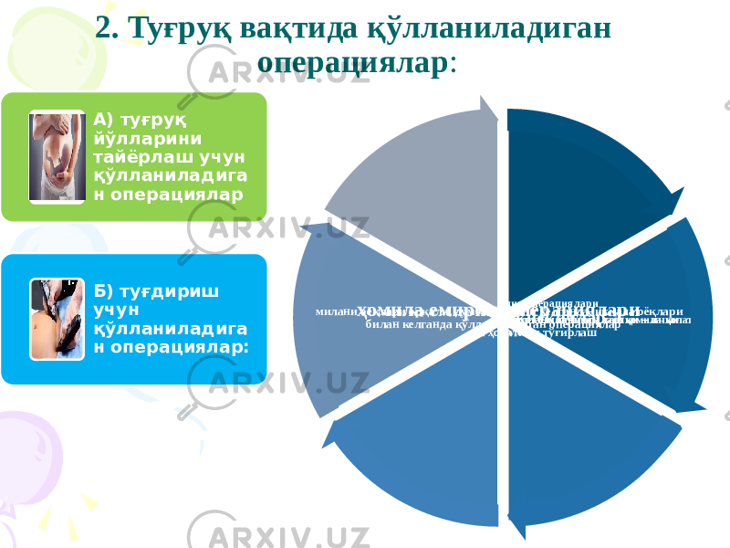 2. Туғруқ вақтида қўлланиладиган операциялар : А) туғруқ йўлларини тайёрлаш учун қўлланиладига н операциялар Б) туғдириш учун қўлланиладига н операциялар: кесар кесиш операциялари акушерлик қисқичлар вакуум – экстракция операциялари - бачадон бўйни тўлиқ очилагандан сўнг ташқи – ички аралаш ҳомила ҳолатини тўғирлаш бачадон бўйни тўлиқ очилмаганда қўлланиладиган ташқи – ички аралаш ҳомила ҳолатини тўғирлаш ҳомилани оёқлари орқали, думбаси билан келганда, иккала оёқлари билан келганда қўлланиладиган операциялар ҳомила емириш операциялари 