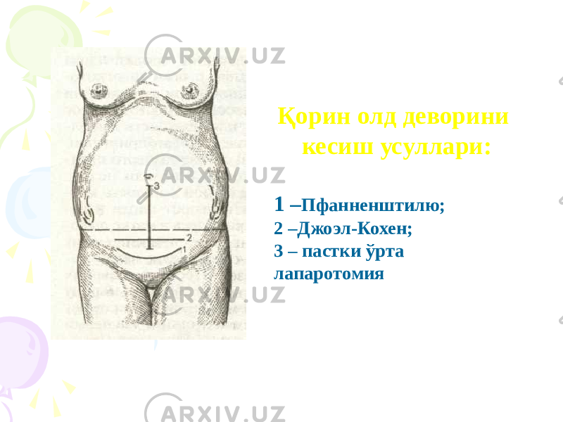 Қорин олд деворини кесиш усуллари: 1 – Пфанненштилю; 2 –Джоэл-Кохен; 3 – пастки ўрта лапаротомия 