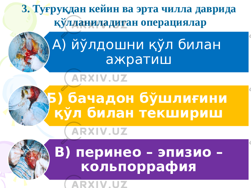 А) йўлдошни қўл билан ажратиш Б) бачадон бўшлиғини қўл билан текшириш В) перинео – эпизио – кольпоррафия3. Туғруқдан кейин ва эрта чилла даврида қўлланиладиган операциялар 