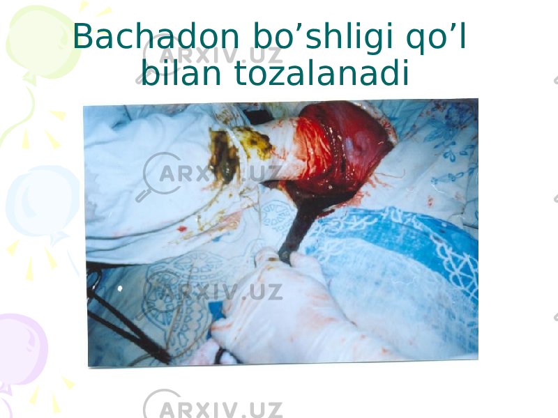 Bachadon bo’shligi qo’l bilan tozalanadi 