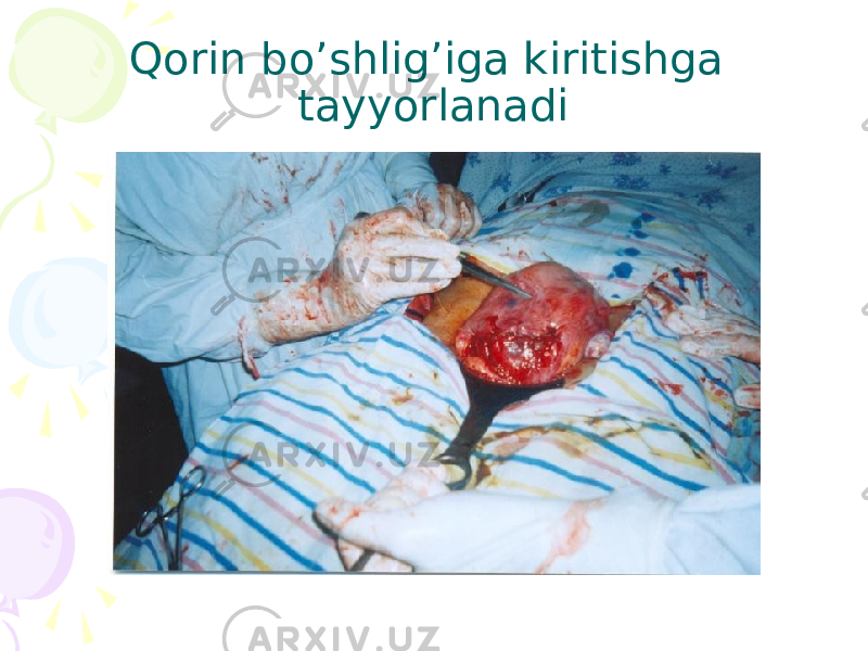 Qorin bo’shlig’iga kiritishga tayyorlanadi 