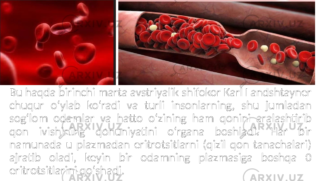 Bu haqda birinchi marta avstriyalik shifokor Karl Landshtayner chuqur oʻylab koʻradi va turli insonlarning, shu jumladan sogʻlom odamlar va hatto oʻzining ham qonini aralashtirib qon ivishining qonuniyatini oʻrgana boshladi. Har bir namunada u plazmadan eritrotsitlarni (qizil qon tanachalari) ajratib oladi, keyin bir odamning plazmasiga boshqa 0 eritrotsitlarini qoʻshadi. 