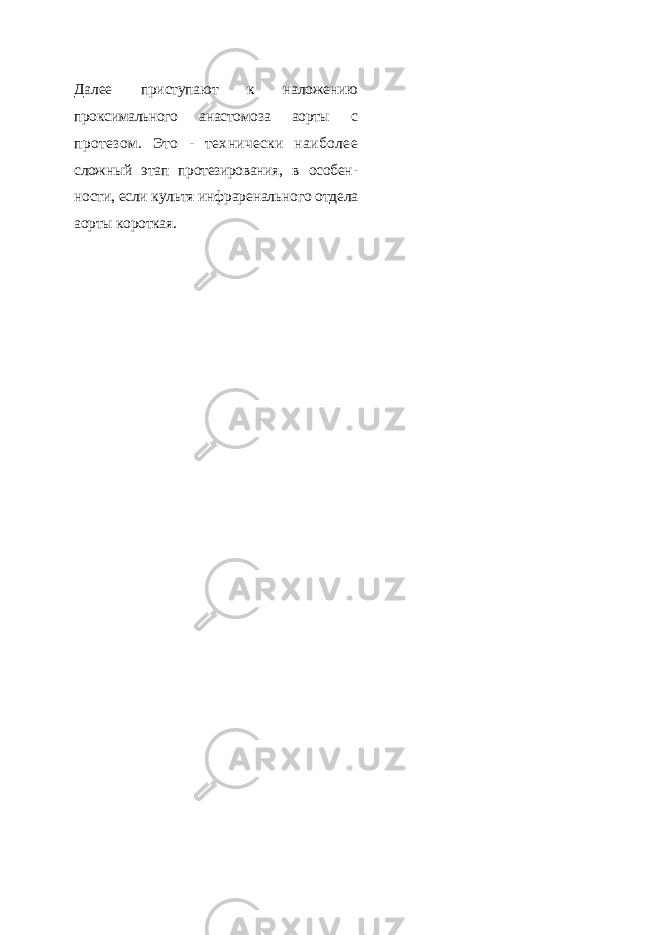 Далее приступают к наложе нию проксимального анастомоза аорты с протезом. Это - технически наиболее сложный этап протезирования, в особен - ности, если культя инфраренального от дела аорты короткая. 