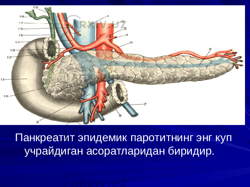 Панкреатит эпидемик паротитнинг энг куп учрайдиган асоратларидан биридир. 