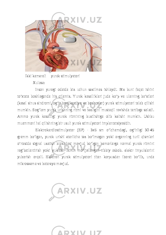 Ikki kamerali yurak stimulyatori Xulosa: Inson yuragi odatda biz uchun sezilmas ishlaydi. Biz buni faqat ishini to’xtata boshlaganda his qilamiz. Yurak kasalliklari juda ko’p va ularning ba’zilari (kasal sinus sindromi, og’ir bradikardiya va boshqalar) yurak stimulyatori talab qilishi mumkin. Sog’lom yurak urishning ritmi va tezligini mustaqil ravishda tartibga soladi. Ammo yurak kasalligi yurak ritmining buzilishiga olib kelishi mumkin. Ushbu muammoni hal qilishning bir usuli yurak stimulyatori implantatsiyasidir. Elektrokardiostimulyator (EP) - 3x5 sm o’lchamdagi, og’irligi 30-45 gramm bo’lgan, yurak urishi etarlicha tez bo’lmagan yoki organning turli qismlari o’rtasida signal uzatish blokadasi mavjud bo’lgan bemorlarga normal yurak ritmini rag’batlantirish yoki yuklash uchun mo’ljallangan tibbiy asbob. elektr impulslarini yuborish orqali. Elektron yurak stimulyatori titan korpusdan iborat bo’lib, unda mikrosxema va batareya mavjud. 