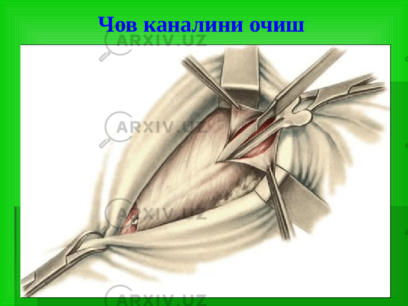 Чов каналини очиш 