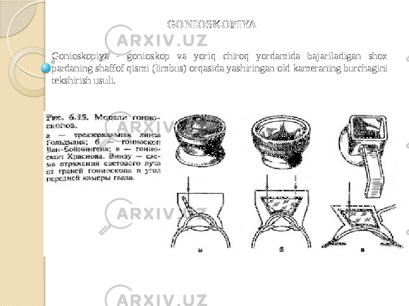 Gonioskopiya - gonioskop va yoriq chiroq yordamida bajariladigan shox pardaning shaffof qismi (limbus) orqasida yashiringan old kameraning burchagini tekshirish usuli. GONIOSKOPIYA 