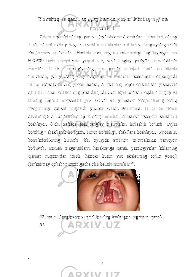 Yumshoq va qattiq tanglay hamda yuqori labning tug’ma nuqsonlari. Odam organizimining yuz va jag’ sistemasi embrional rivojlanishining buzilishi natijasida yuzaga keluvchi nuqsonlardan biri lab va tanglayning to’liq rivojlanmay qolishidir. “Hozirda rivojlangan davlatlardagi tug’ilayotgan har 500-600 inchi chaqaloqda yuqori lab, yoki tanglay yorig’ini kuzatishimiz mumkin. Ushbu patologiyaning tarqalganlik darajasi turli xududlarda turlichadir, yer yuzidagi eng rivojlangan mamlakat hisoblangan Yaponiyada ushbu ko’rsatkich eng yuqori bo’lsa, Afrikaning tropik o’lkalarida yashovchi qara tanli aholi orasida eng past darajada ekanligini ko’rsatmoqda. Tanglay va labning tug’ma nuqsonlari yuz skeleti va yumshoq to’qimasining to’liq rivojlanmay qolishi natijasida yuzaga keladi. Maʼlumki, lablar embrional davrining 5 chi xaftasida chap va o’ng burmalar birlashuvi hisobidan shakllana boshlaydi. 8-chi xaftada esa, tanglay o’simtalari birlashib bo’ladi. Og’iz bo’shlig’i shakllanib bo’lgach, burun bo’shlig’i shakllana boshlaydi. Binobarin, homiladorlikning birinchi ikki oyligida embrion to’qmalarida namoyon bo’luvchi noxush o’zgarishlarni harakteriga qarab, patologiyalar lablarning qisman nuqsonidan tortib, hattoki butun yuz skeletining to’liq yoriqli (birlashmay qolish) nuqsonigacha olib kelishi mumkin” 36 . 12-rasm. Tanglay va yuqori labning kesishgan tugma nuqsoni. 36 2 