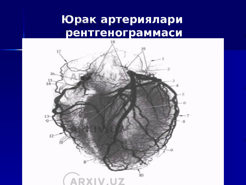 Юрак артериялари рентгенограммаси 