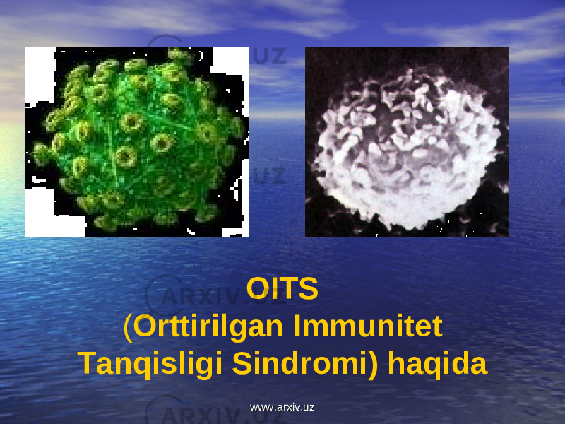 OITS ( Orttirilgan Immunitet Tanqisligi Sindromi) haqida www.arxiv.uzwww.arxiv.uz 