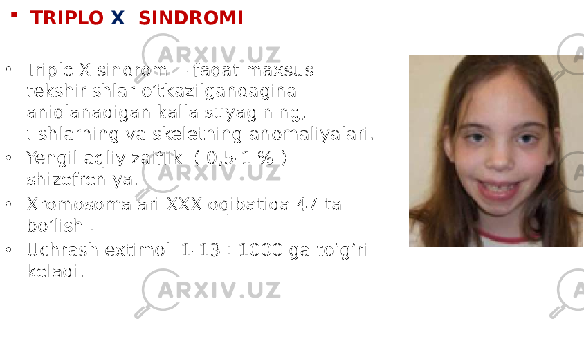  TRIPLO X SINDROMI • Triplo X sindromi – faqat maxsus tekshirishlar o’tkazilgandagina aniqlanadigan kalla suyagining, tishlarning va skeletning anomaliyalari. • Yengil aqliy zaiflik ( 0,5-1 % ) shizofreniya. • Xromosomalari XXX oqibatida 47 ta bo’lishi. • Uchrash extimoli 1-13 : 1000 ga to’g’ri keladi. 