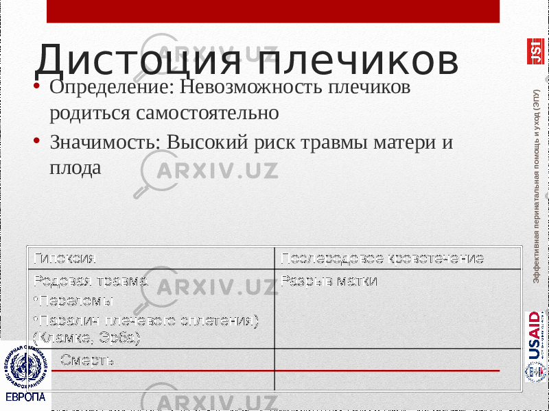 Эффективная перинатальная помощь и уход (ЭПУ)Дистоция плечиков • Определение: Невозможность плечиков родиться самостоятельно • Значимость: Высокий риск травмы матери и плода Гипоксия Послеродовое кровотечение Родовая травма • Переломы • Паралич плечевого сплетения) (Кламке, Эрба) Разрыв матки Смерть 