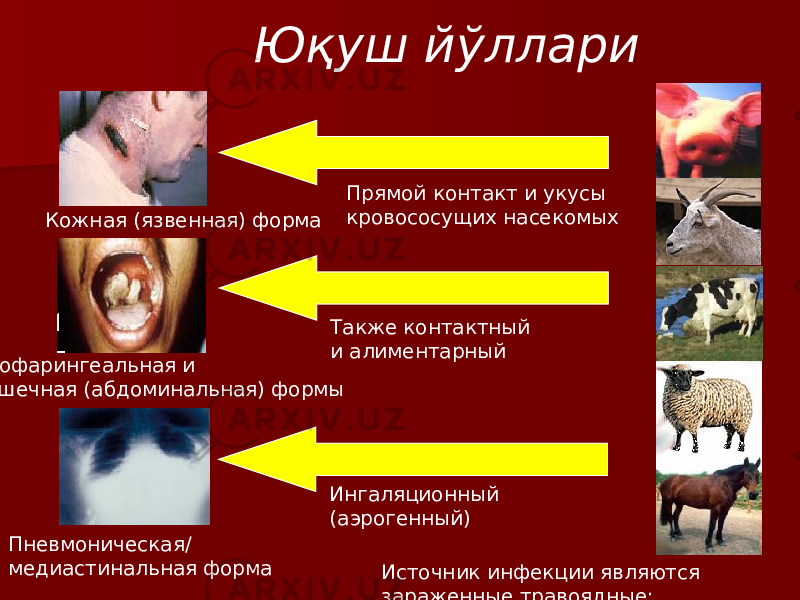 Источник инфекции являются зараженные травоядные; почва может быть резервуаромПрямой контакт и укусы кровососущих насекомыхЮқуш йўллари Кожная (язвенная) форма Также контактный и алиментарный Орофарингеальная и Кишечная (абдоминальная) формы Ингаляционный (аэрогенный) Пневмоническая/ медиастинальная форма 