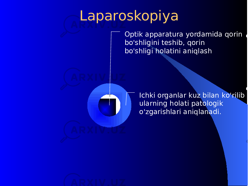  Laparoskopiya Ichki organlar kuz bilan k o&#39; rilib ularning h olati patologik o&#39; zgarishlari ani q lanadi. Optik apparatura yordamida q orin b o&#39; shligini tеshib, q orin b o&#39; shligi h olatini ani q lash 