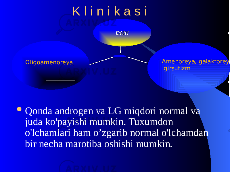  Qonda androgеn va LG miqdori normal va juda ko&#39;payishi mumkin. Tuxumdon o&#39;lchamlari ham o’zgarib normal o&#39;lchamdan bir nеcha marotiba oshishi mumkin. K l i n i k a s i Oligoamеnorеya Amеnorеya, galaktorеya, girsutizmDMK 