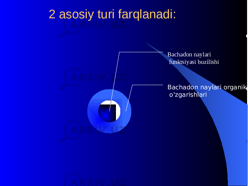  2 asosiy turi farqlanadi: Bachadon naylari organik o&#39; zgarishlari Bachadon naylari funktsiyasi buzilishi 