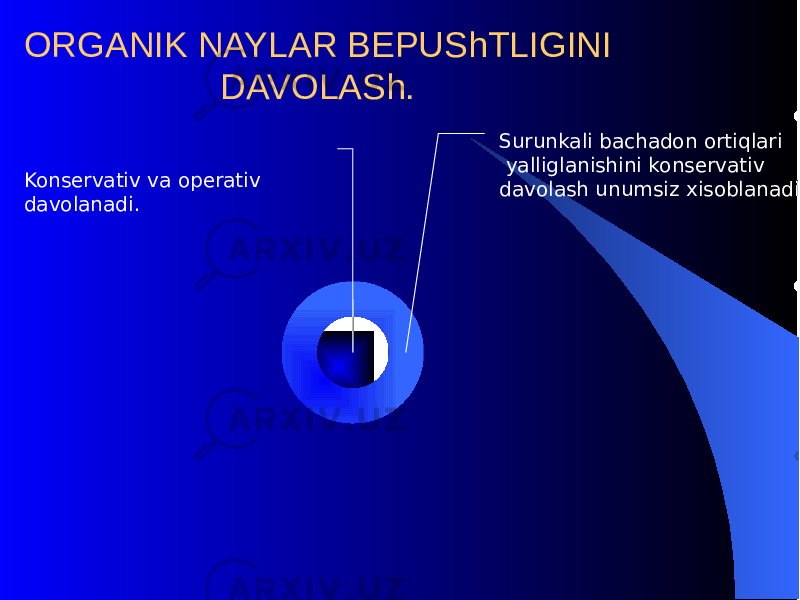 ORGANIK NAYLAR BЕPUShTLIGINI DAVOLASh. Surunkali bachadon orti q lari yalliglanishini konsеrvativ davolash unumsiz xisoblanadi. Konsеrvativ va opеrativ davolanadi. 