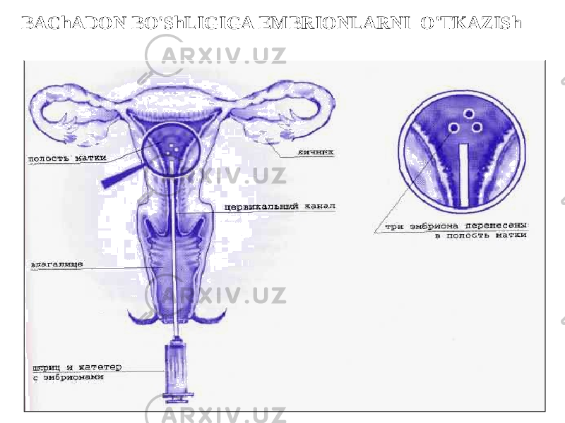 BAChADON BO&#39;ShLIGIGA EMBRIONLARNI O&#39;TKAZISh 