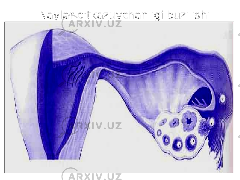  Naylar o&#39; tkazuvchanligi buzilishi 