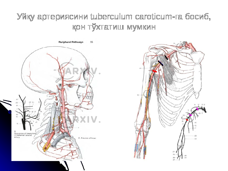 Уйқу артериясини tuberculum caroticum-га босиб, қон тўхтатиш мумкин 