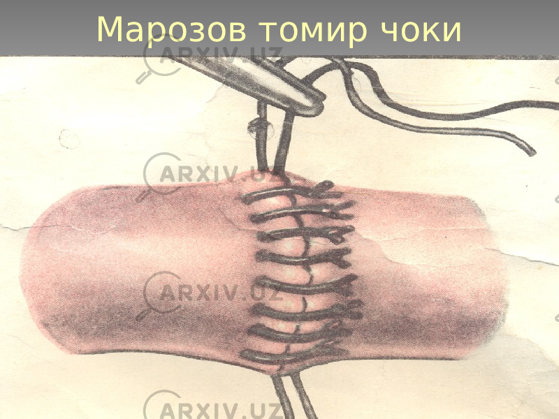 Марозов томир чоки 