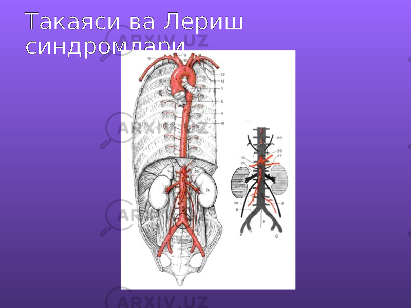 Такаяси ва Лериш синдромлари 