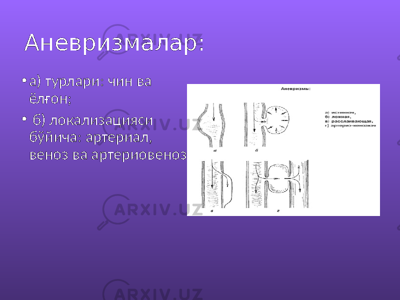 Аневризмалар: • а) турлари: чин ва ёлғон; • б) локализацияси бўйича: артериал, веноз ва артериовеноз. 