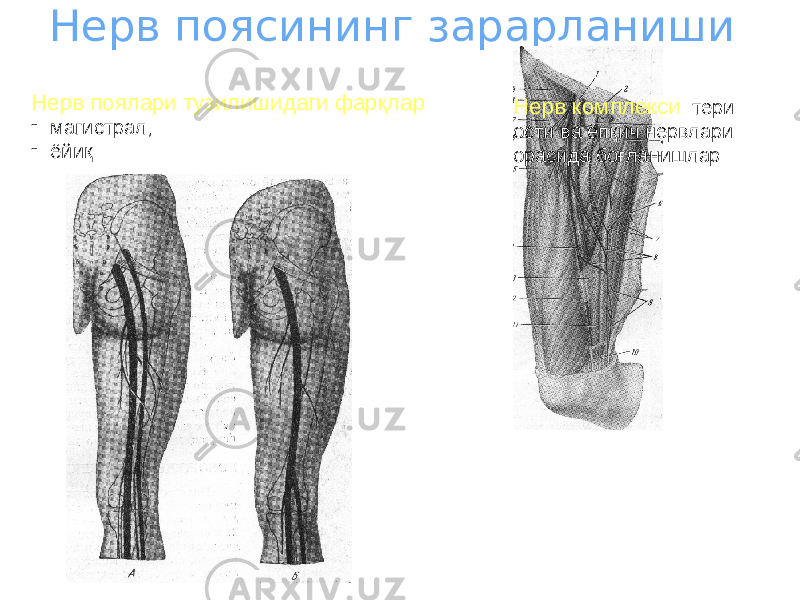 Нерв поясининг зарарланиши Нерв поялари тузилишидаги фарқлар : - магистрал; - ёйиқ Нерв комплекси : тери ости ва ёпқич нервлари орасида боғланишлар 