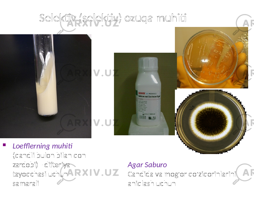 Selektiv (selektiv) ozuqa muhiti  Loefflerning muhiti (qandli bulon bilan qon zardobi) - difteriya tayoqchasi uchun samarali Agar Saburo Candida va mog&#39;or qo&#39;ziqorinlarini aniqlash uchun 