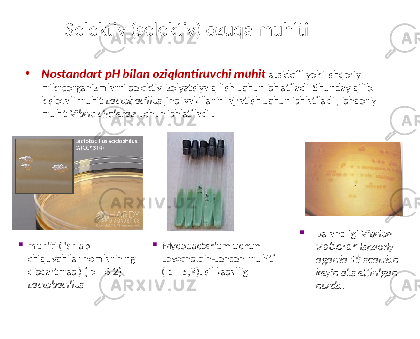 Selektiv (selektiv) ozuqa muhiti • Nostandart pH bilan oziqlantiruvchi muhit atsidofil yoki ishqoriy mikroorganizmlarni selektiv izolyatsiya qilish uchun ishlatiladi. Shunday qilib, kislotali muhit Lactobacillus jinsi vakillarini ajratish uchun ishlatiladi , ishqoriy muhit Vibrio cholerae uchun ishlatiladi .  Balandligi Vibrion vabolar ishqoriy agarda 18 soatdan keyin aks ettirilgan nurda. Mycobacterium uchun Lowenstein-Jensen muhiti ( pH 5,9). sil kasalligi muhiti ( ishlab chiquvchilar nomlarining qisqartmasi) ( pH 6.2) Lactobacillus 