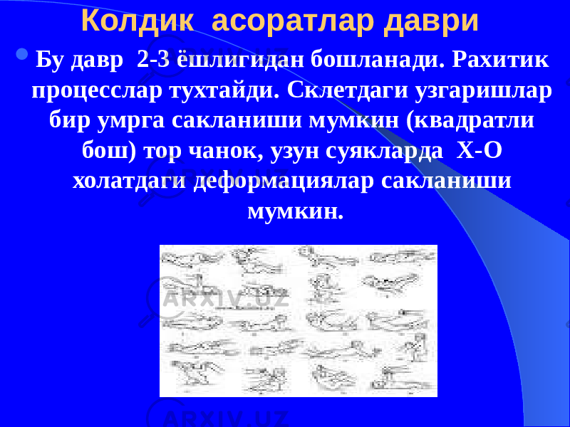 Колдик асоратлар даври  Бу давр 2-3 ёшлигидан бошланади. Рахитик процесслар тухтайди. Склетдаги узгаришлар бир умрга сакланиши мумкин (квадратли бош) тор чанок, узун суякларда Х-О холатдаги деформациялар сакланиши мумкин. 