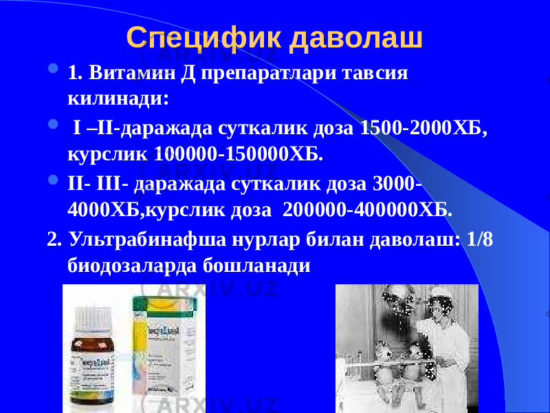 Специфик даволаш  1. Витамин Д препаратлари тавсия килинади:  I –II-даражада суткалик доза 1500-2000ХБ, курслик 100000-150000ХБ.  II- III- даражада суткалик доза 3000- 4000ХБ,курслик доза 200000-400000ХБ. 2. Ультрабинафша нурлар билан даволаш: 1/8 биодозаларда бошланади 