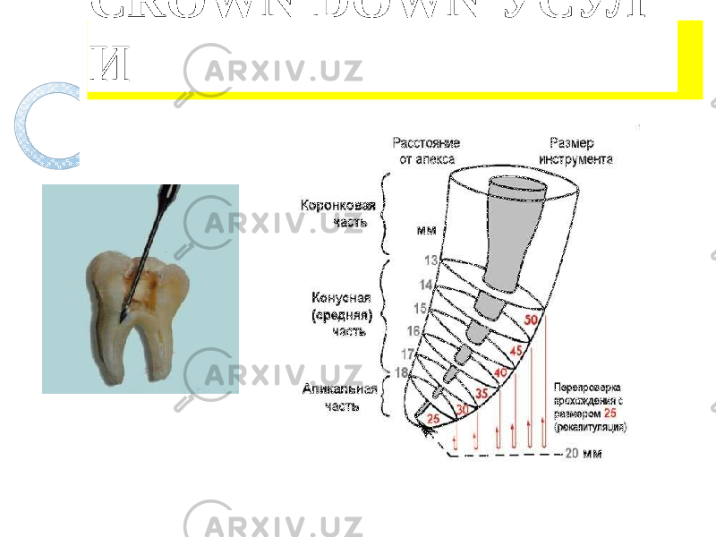 CROWN DOWN УСУЛ И 