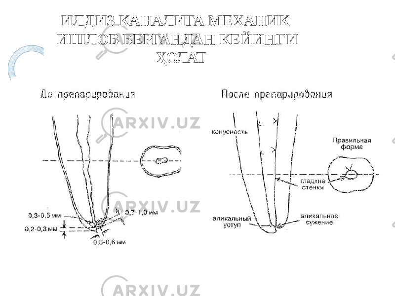 ИЛДИЗ КАНАЛИГА МЕХАНИК ИШЛОВ БЕРГАНДАН КЕЙИНГИ ҲОЛАТ 