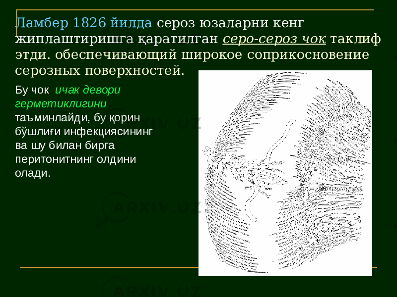 Ламбер 1826 йилда сероз юзаларни кенг жиплаштиришга қаратилган серо-сероз чок таклиф этди. обеспечивающий широкое соприкосновение серозных поверхностей. Бу чок ичак девори герметиклигини таъминлайди, бу қорин бўшлиғи инфекциясининг ва шу билан бирга перитонитнинг олдини олади. 