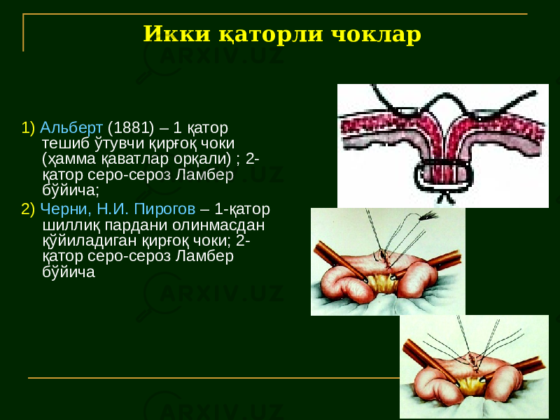 Икки қаторли чоклар 1) Альберт (1881) – 1 қатор тешиб ўтувчи қирғоқ чоки (ҳамма қаватлар орқали) ; 2- қатор серо-сероз Ламбер бўйича; 2) Черни, Н.И. Пирогов – 1-қатор шиллиқ пардани олинмасдан қўйиладиган қирғоқ чоки; 2- қатор серо-сероз Ламбер бўйича 