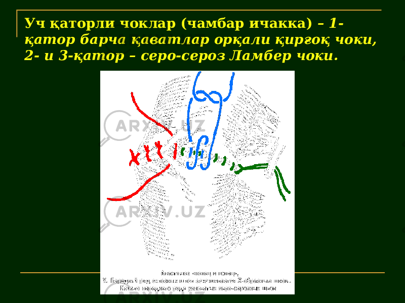 Уч қаторли чоклар (чамбар ичакка) – 1- қатор барча қаватлар орқали қирғоқ чоки, 2- и 3-қатор – серо-сероз Ламбер чоки. 