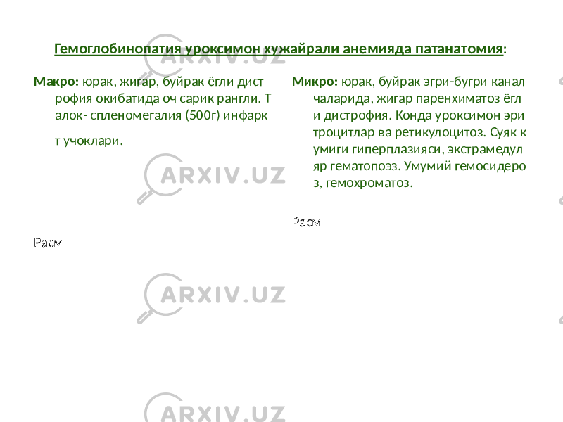 Гемоглобинопатия уроксимон хужайрали анемияда патанатомия : Макро: юрак, жигар, буйрак ёгли дист рофия окибатида оч сарик рангли. Т алок- спленомегалия (500г) инфарк т учоклари. Расм Микро: юрак, буйрак эгри-бугри канал чаларида, жигар паренхиматоз ёгл и дистрофия. Конда уроксимон эри троцитлар ва ретикулоцитоз. Суяк к умиги гиперплазияси, экстрамедул яр гематопоэз. Умумий гемосидеро з, гемохроматоз. Расм 