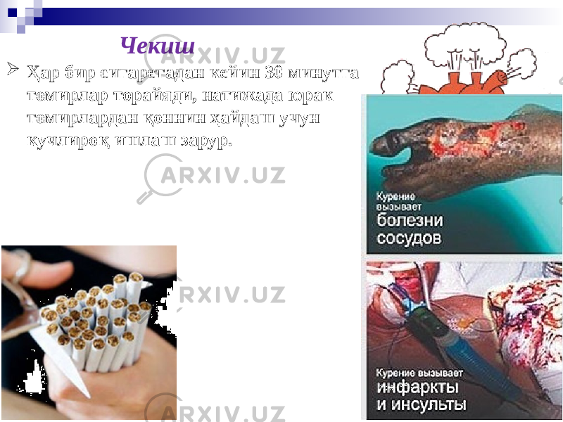 Чекиш  Ҳар бир сигаретадан кейин 30 минутга томирлар торайяди, натижада юрак томирлардан қоннин ҳайдаш учун кучлироқ ишлаш зарур. Сердце курильщика 