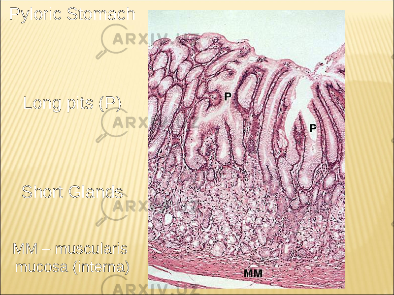 Pyloric Stomach Long pits (P) Short Glands MM – muscularis mucosa (interna) 