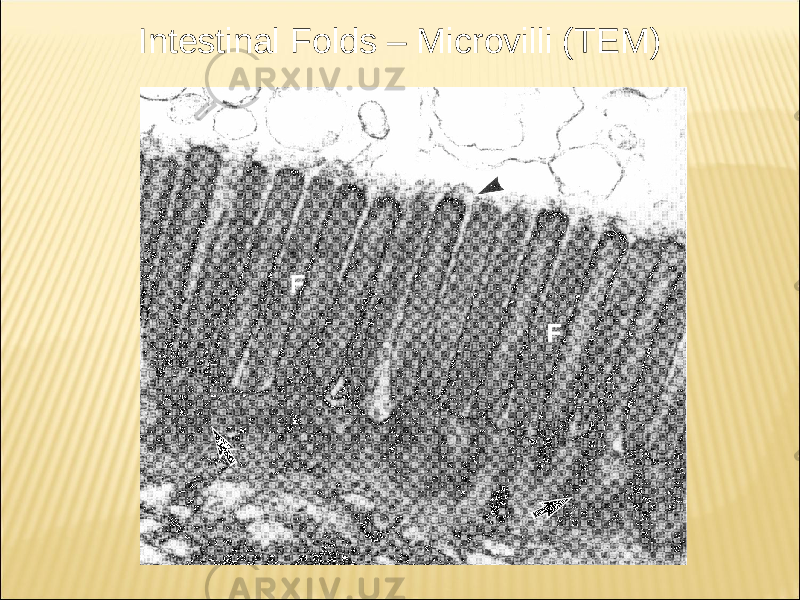 Intestinal Folds – Microvilli (TEM) 