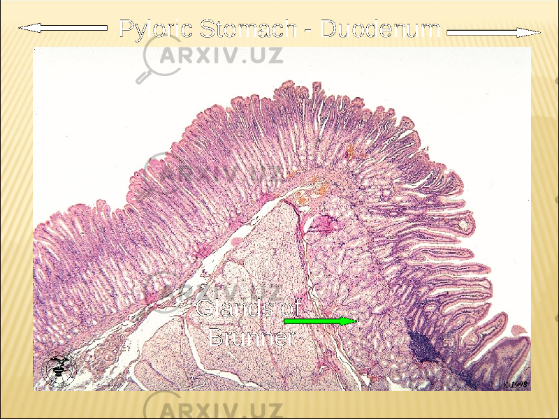 Pyloric Stomach - Duodenum Glands of Brunner 