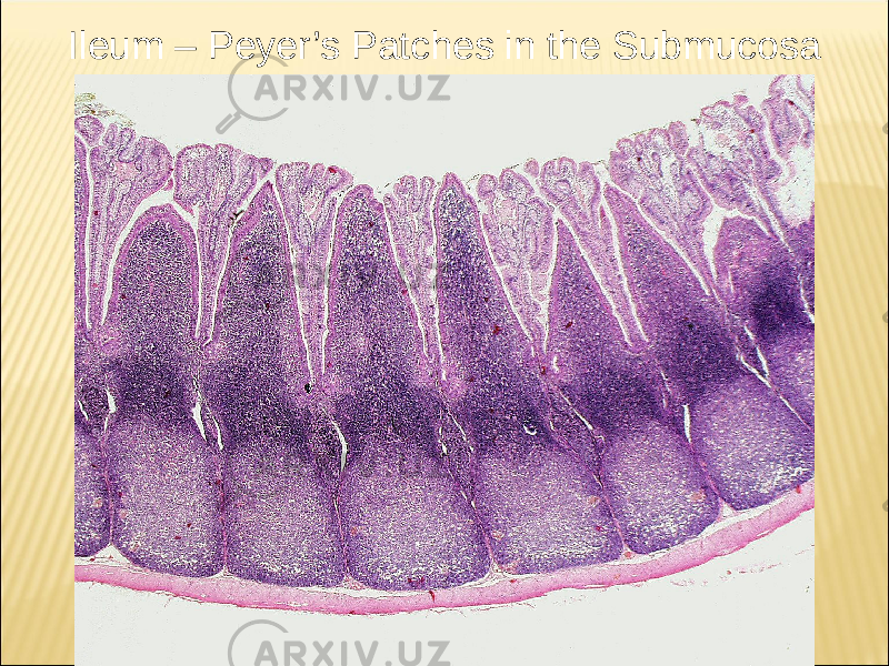 Ileum – Peyer’s Patches in the Submucosa 