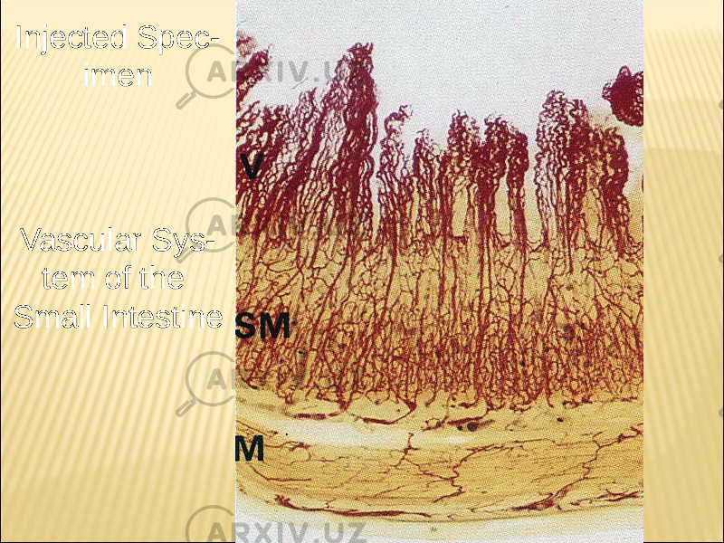 Injected Spec - imen Vascular Sys - tem of the Small Intestine 