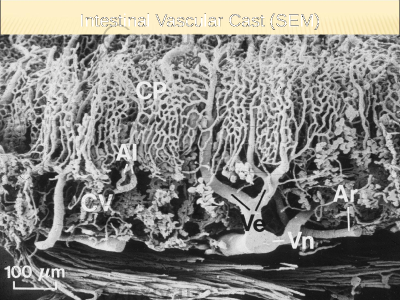 Intestinal Vascular Cast (SEM) 