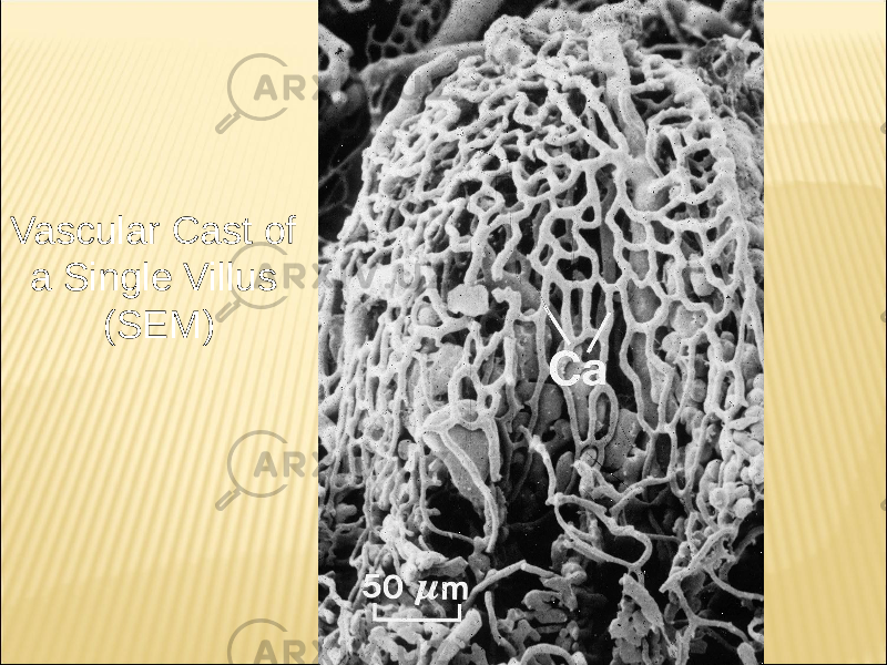 Vascular Cast of a Single Villus (SEM) 